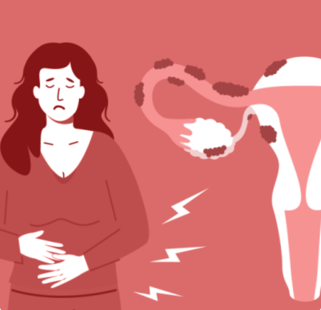 Understanding Ovulation Pain: When Your Mid-cycle Throbs Don’t Mean You 